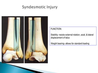 FUNCTION:

Stability- resists external rotation, axial, & lateral
displacement of talus

Weight bearing- allows for standard loading
 