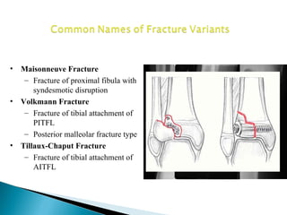 •   Maisonneuve Fracture
     – Fracture of proximal fibula with
        syndesmotic disruption
•   Volkmann Fracture
     – Fracture of tibial attachment of
        PITFL
     – Posterior malleolar fracture type
•   Tillaux-Chaput Fracture
     – Fracture of tibial attachment of
        AITFL
 