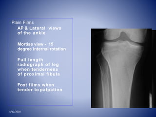 • Plain Films
AP & Lateral views
of the ankle
Mortise view - 15
degree internal rotation
Full length
radiograph of leg
when tenderness
of proximal fibula
Foot films when
tender to palpation
5/12/2018
 