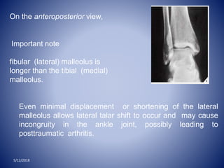 On the anteroposterior view,
Important note
fibular (lateral) malleolus is
longer than the tibial (medial)
malleolus.
Even minimal displacement or shortening of the lateral
malleolus allows lateral talar shift to occur and may cause
incongruity in the ankle joint, possibly leading to
posttraumatic arthritis.
5/12/2018
 