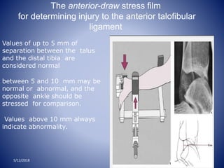 The anterior-draw stress film
for determining injury to the anterior talofibular
ligament
Values of up to 5 mm of
separation between the talus
and the distal tibia are
considered normal
between 5 and 10 mm may be
normal or abnormal, and the
opposite ankle should be
stressed for comparison.
Values above 10 mm always
indicate abnormality.
5/12/2018
 