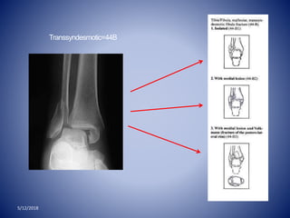 5/12/2018
Transsyndesmotic=44B
 