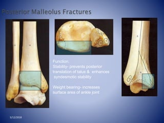 Function:
Stability- prevents posterior
translation of talus & enhances
syndesmotic stability
Weight bearing- increases
surface area of ankle joint
5/12/2018
 