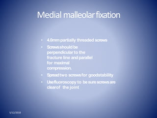 Medialmalleolarfixation
5/12/2018
• 4.0mmpartially threaded screws
• Screwsshouldbe
perpendicular to the
fracture line andparallel
for maximal
compression.
• Spreadtwo screwsfor goodstability
• Usefluoroscopy to besurescrewsare
clearof the joint
 