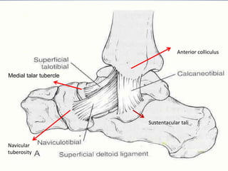 Medial talar tubercle
Navicular
tuberosity
Anterior colliculus
Sustentacular tali
5/12/2018
 