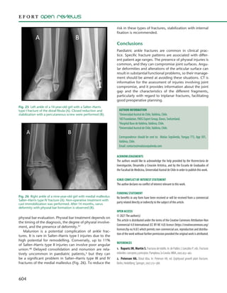 604
physeal bar evaluation. Physeal bar treatment depends on
the timing of the diagnosis, the degree of physeal involve-
ment, and the presence of deformity.51
Malunion is a potential complication of ankle frac-
tures. It is rare in Salter–Harris type I injuries due to the
high potential for remodelling. Conversely, up to 11%
of Salter–Harris type II injuries can involve poor angular
union.48 Delayed consolidation and nonunion are rela-
tively uncommon in paediatric patients,3 but they can
be a significant problem in Salter–Harris type III and IV
fractures of the medial malleolus (Fig. 26). To reduce the
risk in these types of fractures, stabilization with internal
fixation is recommended.
Conclusions
Paediatric ankle fractures are common in clinical prac-
tice. Specific fracture patterns are associated with differ-
ent patient age ranges. The presence of physeal injuries is
common, and they can compromise joint surfaces. Angu-
lar deformities and alterations of the articular surface can
result in substantial functional problems, so their manage-
ment should be aimed at avoiding these situations. CT is
informative for the assessment of injuries involving joint
compromise, and it provides information about the joint
gap and the characteristics of the different fragments,
particularly with regard to triplanar fractures, facilitating
good preoperative planning.
Acknowledgements
The authors would like to acknowledge the help provided by the Vicerrectoría de
Investigación, Desarrollo y Creación Artística, and by the Escuela de Graduados of
the Facultad de Medicina, Universidad Austral de Chile in order to publish this work.
ICMJE Conflict of interest statement
The author declares no conflict of interest relevant to this work.
Funding statement
No benefits in any form have been received or will be received from a commercial
party related directly or indirectly to the subject of this article.
Open access
© 2021The author(s)
This article is distributed under the terms of the Creative Commons Attribution-Non
Commercial 4.0 International (CC BY-NC 4.0) licence (https://creativecommons.org/
licenses/by-nc/4.0/) which permits non-commercial use, reproduction and distribu-
tion of the work without further permission provided the original work is attributed.
References
1. Rapariz JM, Martín S.Fracturasdetobillo.In:dePablosJ,GonzálezP,eds.Fracturas
infantiles:conceptosyprincipios.Pamplona,laCoruña:MBA,2005:453–462.
2. Peterson HA. Distal tibia. In: Peterson HA, ed. Epiphyseal growth plate fractures.
Berlin,Heidelberg:Springer,2007:273–388.
Fig. 25  Left ankle of a 14-year-old girl with a Salter–Harris
type I fracture of the distal fibula (A). Closed reduction and
stabilization with a percutaneous screw were performed (B).
Fig. 26  Right ankle of a nine-year-old girl with medial malleolus
Salter–Harris type IV fracture (A). Non-operative treatment with
cast immobilization was performed. After 14 months, varus
deformity with physeal bar formation is observed (B).
Author Information
1Universidad Austral de Chile,Valdivia, Chile.
2AO Foundation, PAEG Expert Group, Davos, Switzerland.
3Hospital Base deValdivia,Valdivia, Chile.
4Universidad Austral de Chile,Valdivia, Chile.
Correspondence should be sent to: Matías Sepúlveda, Yungay 773, App 501,
Valdivia, Chile.
Email: contacto@matiassepulveda.com
 