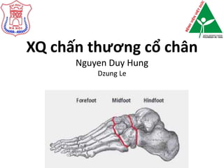 XQ chấn thương cổ chân
Nguyen Duy Hung
Dzung Le
 
