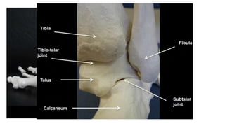 Musculoskeletal Ultrasound guided Ankle injection.pptx