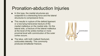 ankle injuries.pptx