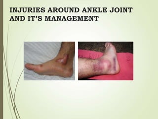 INJURIES AROUND ANKLE JOINT
AND IT’S MANAGEMENT
 