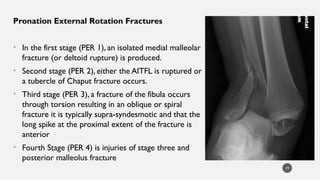 ankle injuries(15-12-2022) copy-1.pptx ppf | PPTX