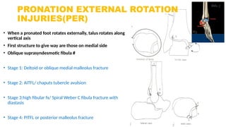 Ankle Rptation Injury injuries around the ankle joint , orthopaedics | PPTX