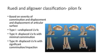 injuries around the ankle joint , orthopaedics | PPTX