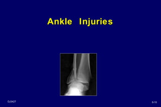 Ankle injury | PPT