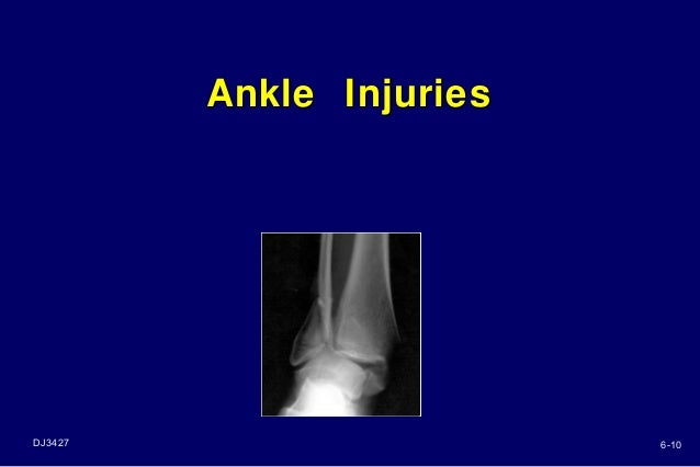 Ankle Injury
