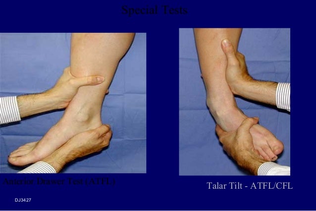 Exame tilt test