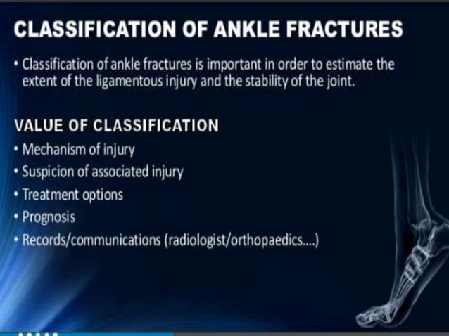 all types of Ankle fracture by kajal | PPT