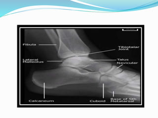 Angulo Tobillo RADIOGRAPHIC VIEWS OF ANKLE JOINT | PPTX