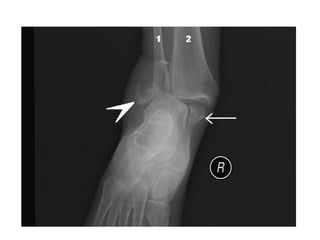 Ankle joint which are interesting to study