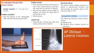 Ankle Joint teknik radiologi ankle joint | PPTX