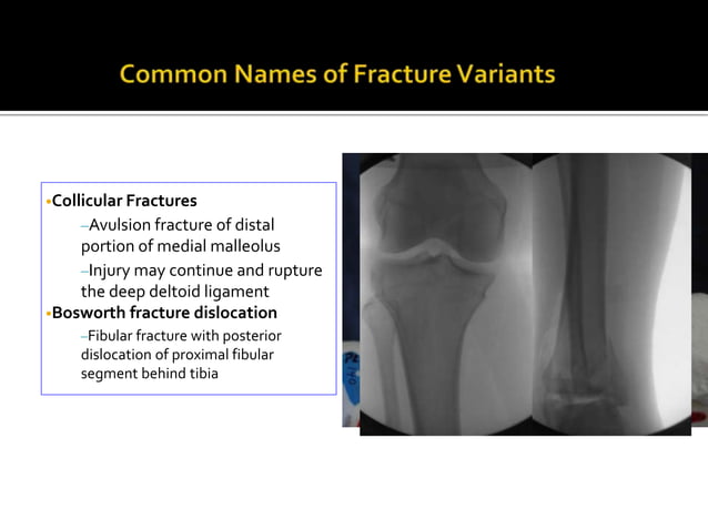 Ankle joint final | PPT | Free download