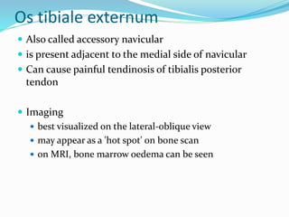 Os tibiale externum
 Also called accessory navicular
 is present adjacent to the medial side of navicular
 Can cause painful tendinosis of tibialis posterior
tendon
 Imaging
 best visualized on the lateral-oblique view
 may appear as a 'hot spot' on bone scan
 on MRI, bone marrow oedema can be seen
 