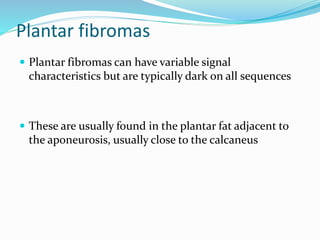 Plantar fibromas
 Plantar fibromas can have variable signal
characteristics but are typically dark on all sequences
 These are usually found in the plantar fat adjacent to
the aponeurosis, usually close to the calcaneus
 