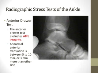Radiographic Stress Tests of the Ankle

• Anterior Drawer
  Test
 • The anterior
   drawer test
   evaluates ATFL
   integrity.
 • Abnormal
   anterior
   translation is
   between 5 to 10
   mm, or 3 mm
   more than other
   side
 