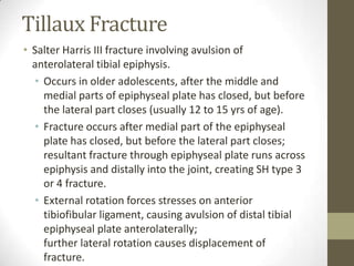 Tillaux Fracture
• Salter Harris III fracture involving avulsion of
  anterolateral tibial epiphysis.
  • Occurs in older adolescents, after the middle and
    medial parts of epiphyseal plate has closed, but before
    the lateral part closes (usually 12 to 15 yrs of age).
  • Fracture occurs after medial part of the epiphyseal
    plate has closed, but before the lateral part closes;
    resultant fracture through epiphyseal plate runs across
    epiphysis and distally into the joint, creating SH type 3
    or 4 fracture.
  • External rotation forces stresses on anterior
    tibiofibular ligament, causing avulsion of distal tibial
    epiphyseal plate anterolaterally;
    further lateral rotation causes displacement of
    fracture.
 