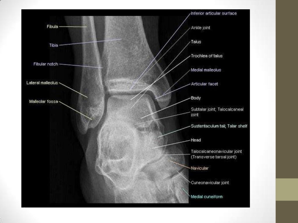 Ankle joint radiography