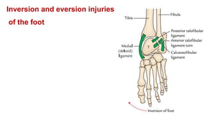 Talocrural Inversion/eversion Mobilization Ankle Joint (TALOCRURAL JOINT) Dr M Arshad.pptx