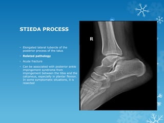 ankle MRI.pptx [Repaired].pptx