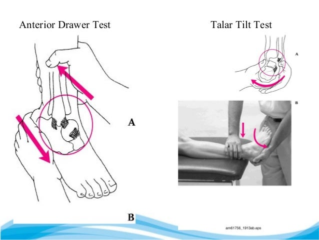 Ankle Ppt