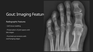 Double Contour Radiology ANKLE PPT FINAL radiologist perspective .pptx