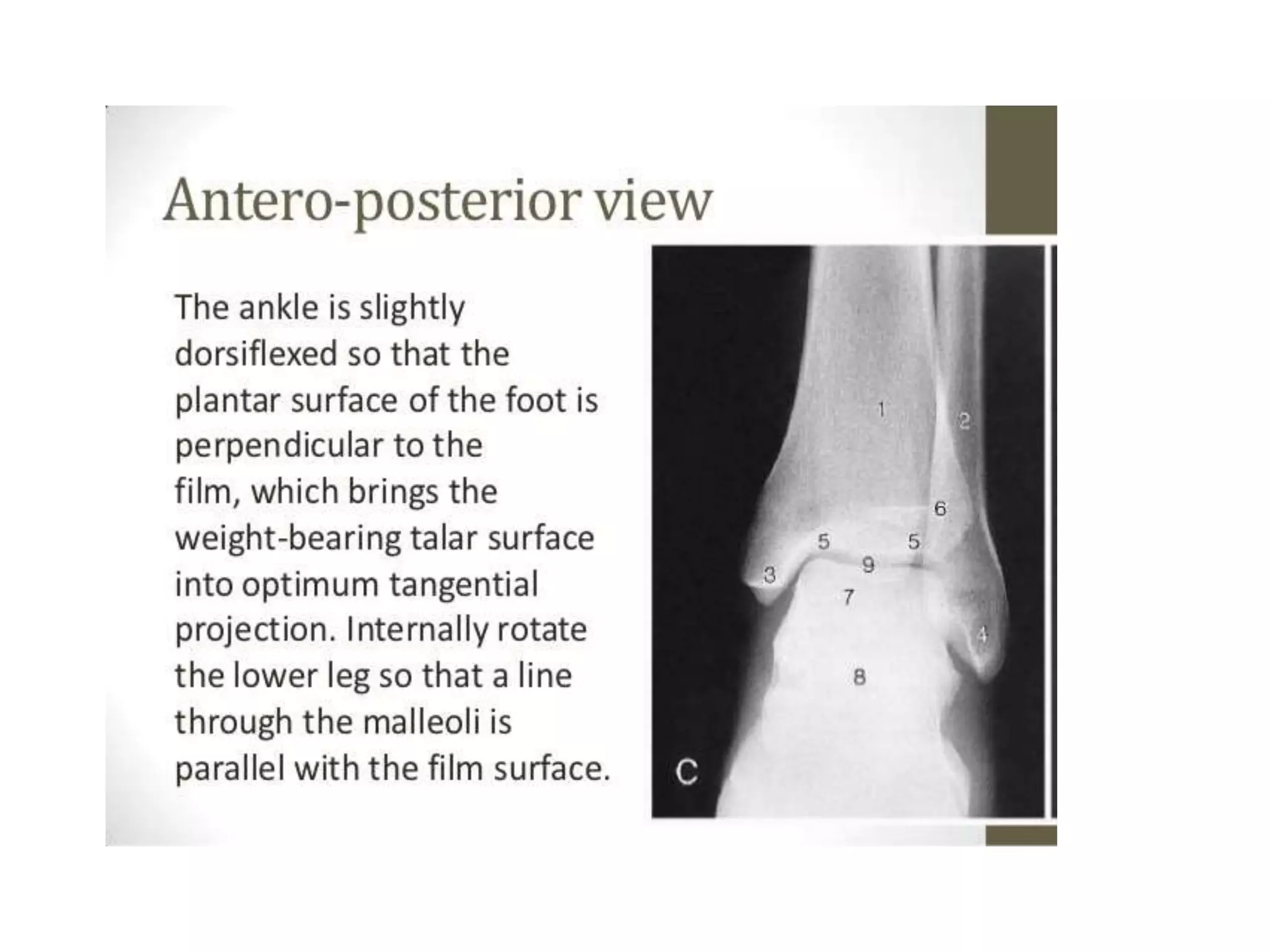 Angulo Tobillo Ankle radiological anatomy | PPTX