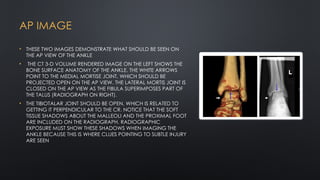 Radiological Features for Evaluation of the Ankle | PPTX