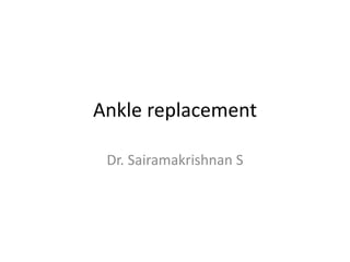 Ankle replacement
Dr. Sairamakrishnan S
 