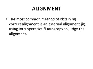 ALIGNMENT
• The most common method of obtaining
correct alignment is an external alignment jig,
using intraoperative fluoroscopy to judge the
alignment.
 