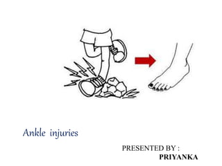 Ankle injuries
PRESENTED BY :
PRIYANKA
 