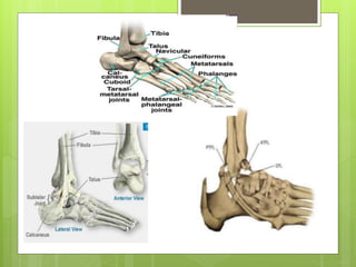 Ankle sprain | PPT