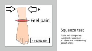 Ankle sprain | PPT