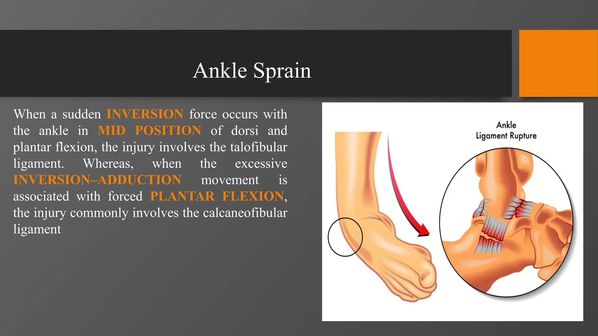 Ankle Sprain mechanism of injury physiotherapeutic assessment and ...
