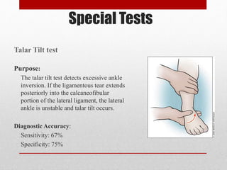 Talar Test Ankle Sprain | PPTX