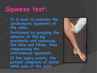 Ankle Sprains | PPTX