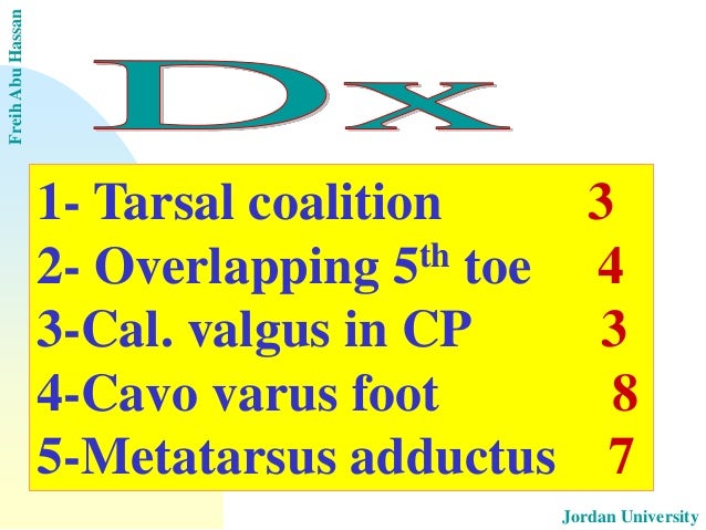 Ankle tourniquet البروفيسور فريح ابوحسان