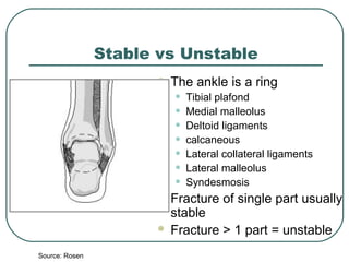 Stable vs Unstable 
 The ankle is a ring 
• Tibial plafond 
• Medial malleolus 
• Deltoid ligaments 
• calcaneous 
• Lateral collateral ligaments 
• Lateral malleolus 
• Syndesmosis 
 Fracture of single part usually 
stable 
 Fracture > 1 part = unstable 
Source: Rosen 
 