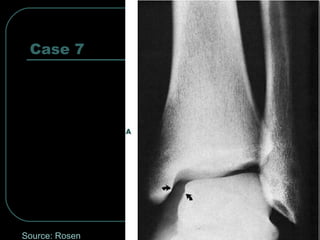 Case 7 
Source: Rosen 
 