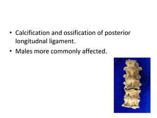 • Calcification and ossification of posterior
longitudnal ligament.
• Males more commonly affected.
 