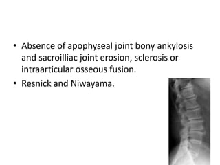 • Absence of apophyseal joint bony ankylosis
and sacroilliac joint erosion, sclerosis or
intraarticular osseous fusion.
• Resnick and Niwayama.
 