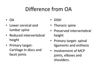 Difference from OA
• OA
• Lower cervical and
lumbar spine
• Reduced intervertebral
height
• Primary target-
Cartilage in discs and
facet joints
• DISH
• Thoracic spine
• Preserved intervertebral
height
• Primary target- spinal
ligaments and enthesis
• Involvement of MCP
joints, elbows and
shoulders.
 